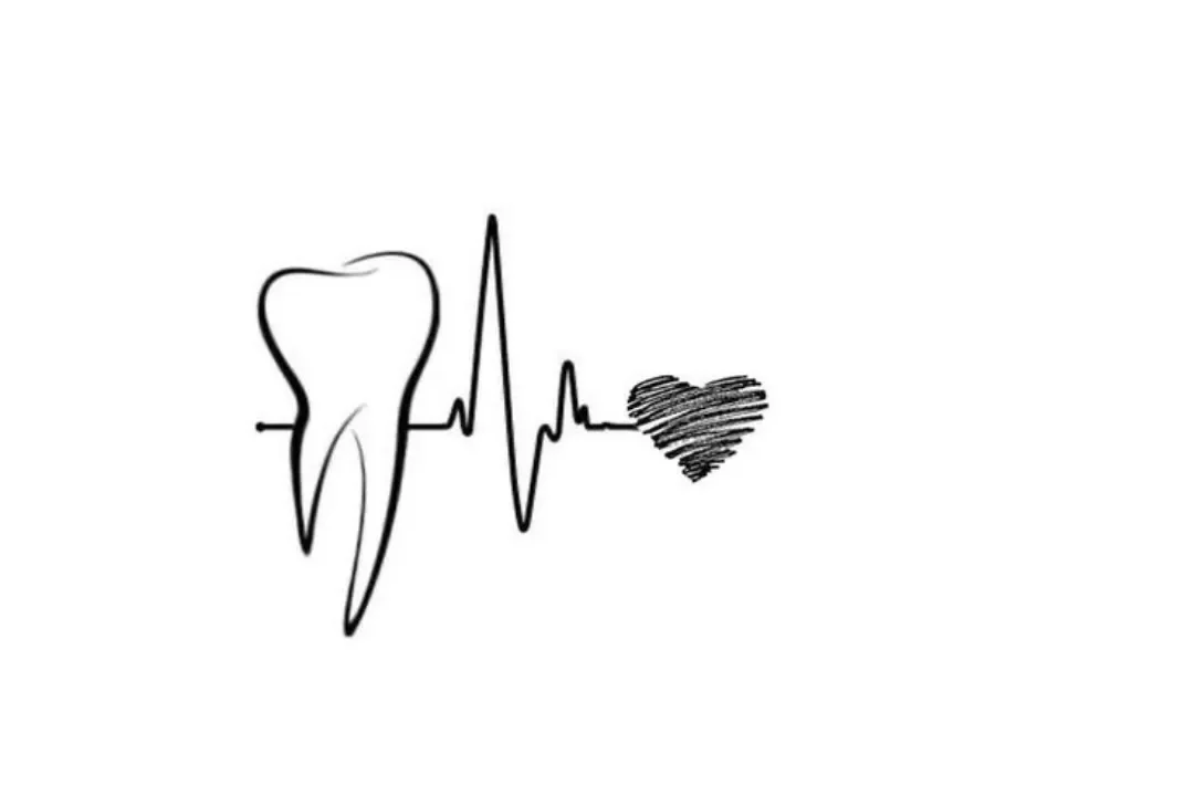 Implantes dentales en Torremolinos